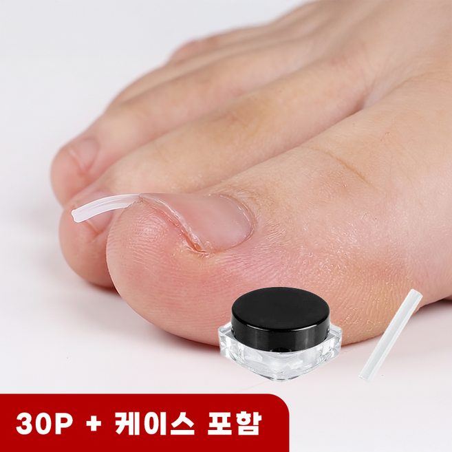 라이프엔라이크 파고드는 발톱 케어 스틱 30p 내성발톱 셀프 관리 교정패치, 30개