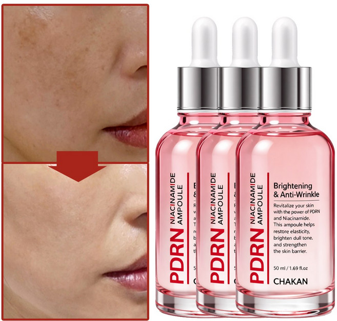 기미 잡티 주근깨 보습 모공 피디알엔 PDRN 나이아신아마이드 앰플, 3개, 50ml