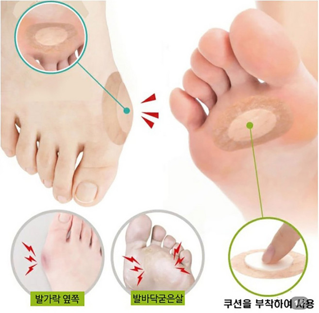 일본수입정품 발바닥 통증을 완화시켜주는 티눈 굳은살 커버 밴드 세모아 티눈 보호 밴드 36매, 1개