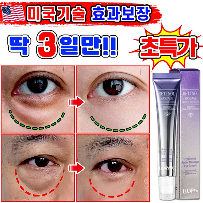 [효과보장] 1/1+1/2+2 아이백 리프팅 900샷 아이크림 눈 밑 지방 볼륨 개선 눈밑지방 제거 아이백 크림 다크서클 눈밑꺼짐 제거 아이케어 LUPEIYA 포장증정, 1개, 20g