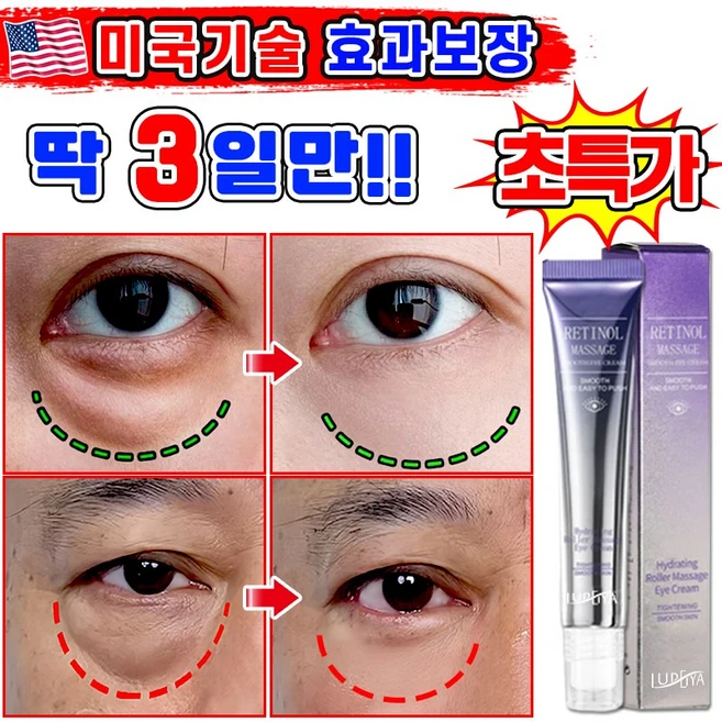 [효과보장] 1/1+1/2+2 아이백 리프팅 900샷 아이크림 눈 밑 지방 볼륨 개선 눈밑지방 제거 아이백 크림 다크서클 눈밑꺼짐 제거 아이케어 LUPEIYA 포장증정, 1개, 20g - 쿠팡