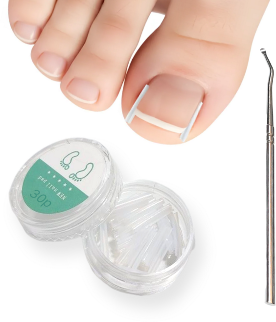 피아루네 파고드는 발톱 셀프 케어 관리 용품, 1세트