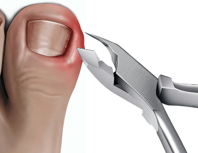 나팔래옹 내성 발톱깎이 네일 니퍼 큐티클 손톱, 1개