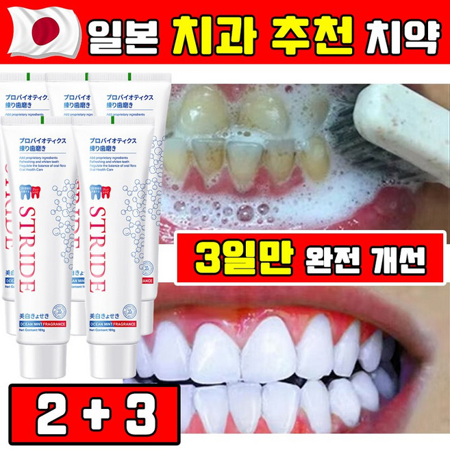 [강력 미백] 1/1+1/2+2 일본 누렁니 미백 치약 추천 1위 화이트닝 치약 입냄새 제거 치약 치석 제거 Stride 치솔 50개만 선착순!, 100g, 5개