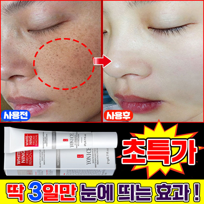 {국내배송 | 100% 효과있음} 1/1+1/2+2 기미크림 기미 잡티 주근깨 검버섯 제거 크림 색소침착 미백 크림 들깨기미크림 화이트닝 LUPEIYA, 1개, 20.01g