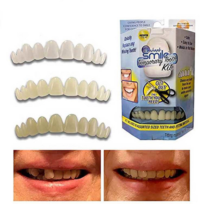 인조 빠진 성형 앞니 틈새 가능한 빠진이 키트 갈라지고 50g 100g 임시, 50x0x0g