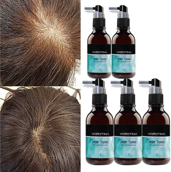 바로티나 탈모증상완화 두피 기능성 토닉 앰플, 100ml, 5개