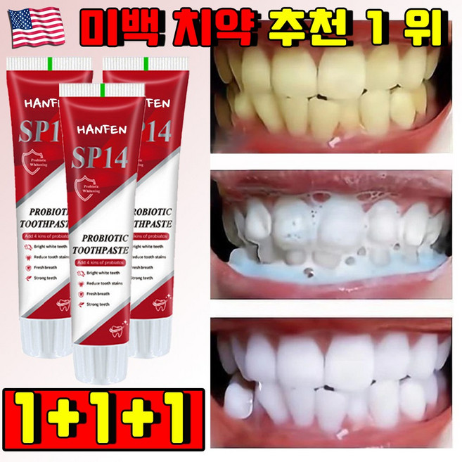 [미백보장] 미국 프리미엄 SP14 미백 치약 추천 1 위 화이트닝 치약 치아미백 치석제거 치약 누렁니 미백치약 잇몸 치약 무불소 치약, 3개
