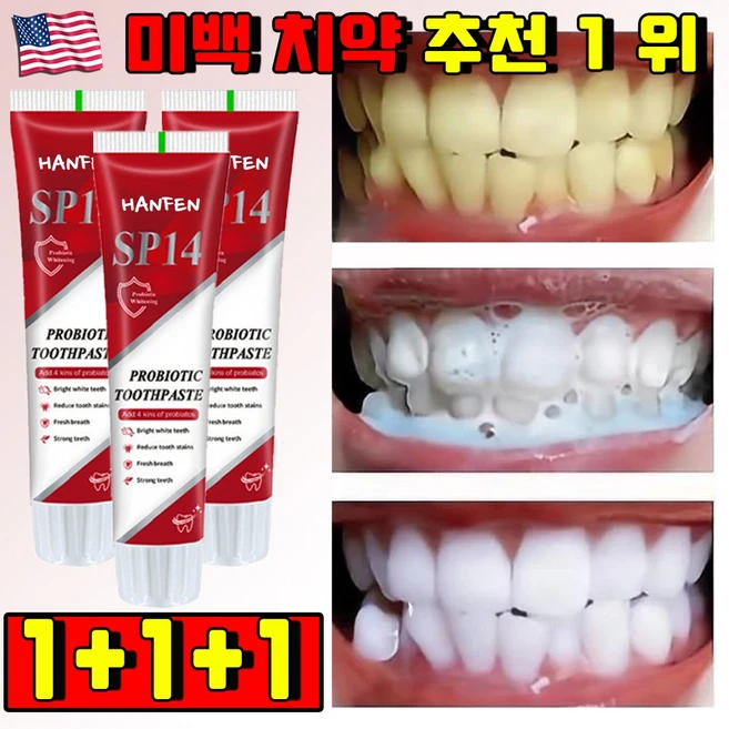 [미백보장] 미국 프리미엄 SP14 미백 치약 추천 1 위 화이트닝 치약 치아미백 치석제거 치약 누렁니 미백치약 잇몸 치약 무불소 치약, 3개 - 쿠팡