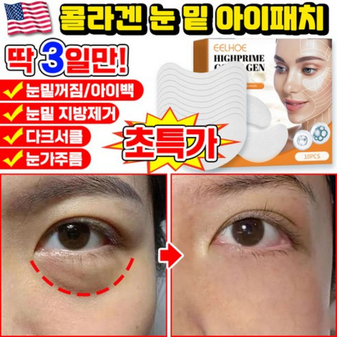 [당일출고] 미국기술 10/10+10/20+20 콜라겐 아이패치 눈밑 지방제거 패치 다크서클 눈밑꺼짐 제거 아이팩 눈가주름 패치 아이백 리프팅 아이케어 사은품 랜덤 증정, 1개, 10개입
