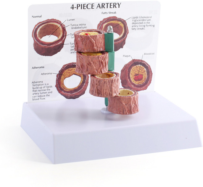 정수생활건강 인체모형 동맥 혈관 인체 해부학 교육 실습용, 혈관모형B, 1개