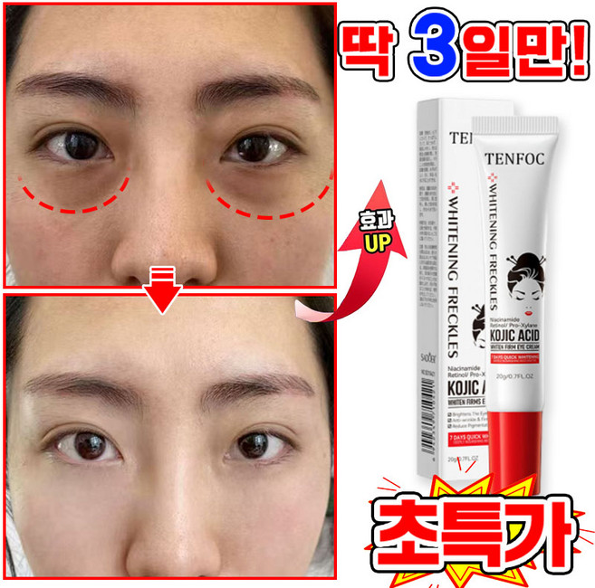 [국내배송] 1/1+1/2+2 다크서클 눈밑꺼짐 개선 아이백 아이크림 아이팔트 아이백 크림 눈밑 지방제거 눈 밑 지방 볼륨 개선 눈가 주름개선 리프팅 아이케어, 1개, 20.01g