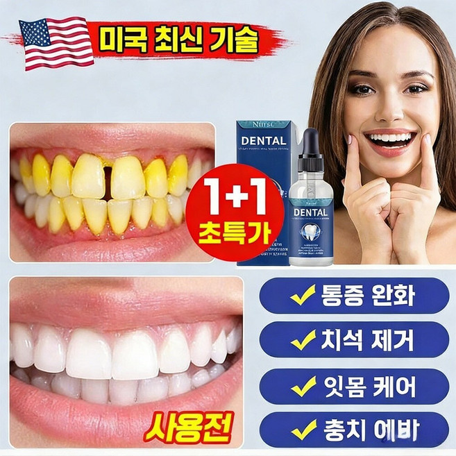 치아 재생 케어 치아 점적제 하이드아파타이트 치아 보호 드롭제 /치아미백 /잇몸 재생 염증 케어 예방 완화, 4개, 30ml