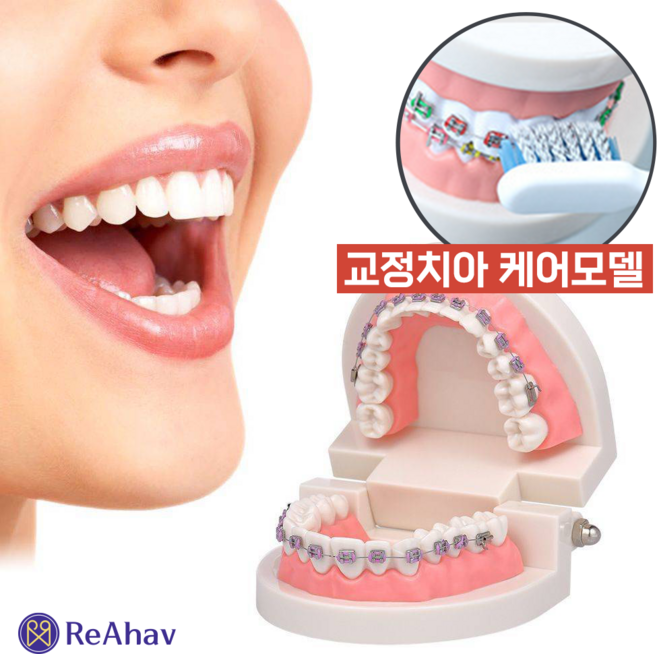 레아하브 덴트에듀 치과 모델 치아 교정 모형 치열 교정기 실습 틀니 연습 교구, 1세트
