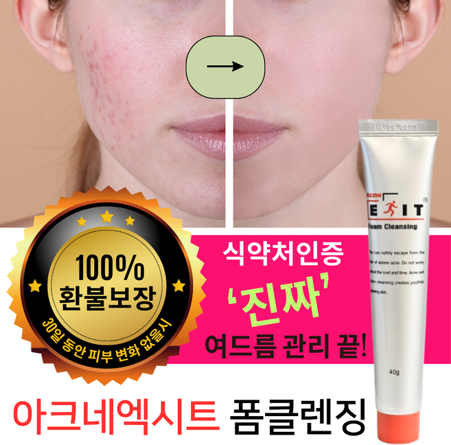 아크네 엑시트 폼 클렌징, 1개, 40g