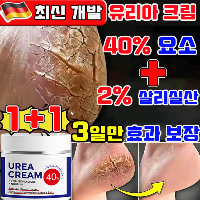 유리아 크림 유리아 풋크림 함익병 유레아 크림 피부연화제 유리아크림 함익병 유레아 크림 뒷꿈치 고보습 유레아 크림 100% 발바닥 각질제거 크림 사은품 랜덤 증정, 2개, 100g