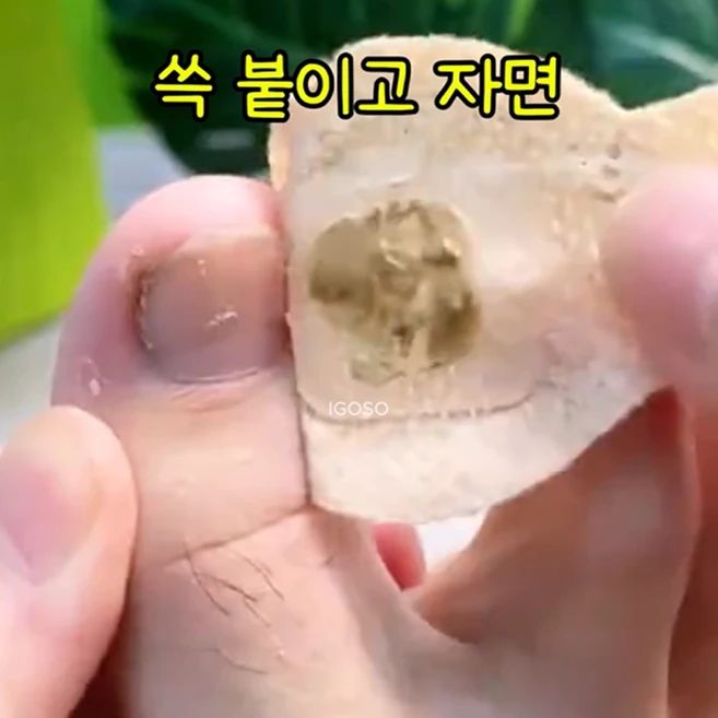 발톱 손톱 변색 무좀 파고듦 곰팡이균 억제 발톱패치 나이트 타임, 28매입, 1개 - 쿠팡