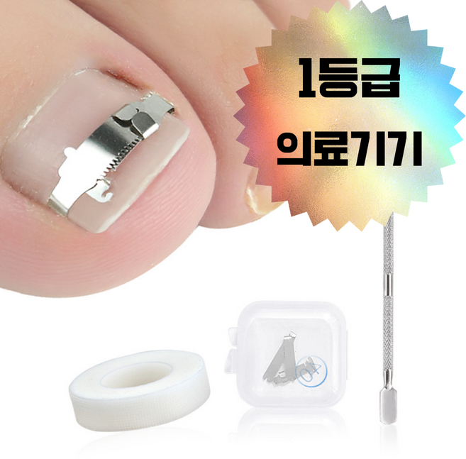 비비오AI 내성발톱 교정기 셀프, 1세트