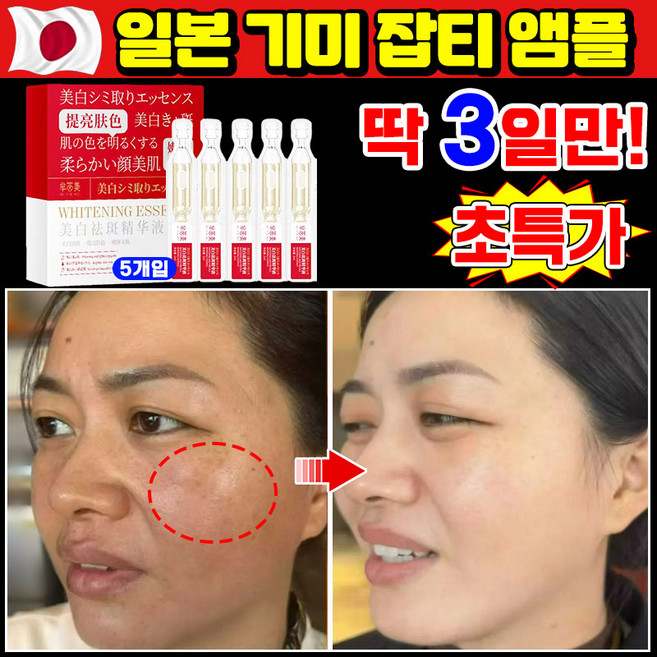 [100% 효과있음] 1/1+1/2+2 기미 미백 앰플 잡티 주근깨 검버섯 제거 세럼 비타민c 앰플 멜라논 에선스 화이트닝 색소침착, 1개, 10ml