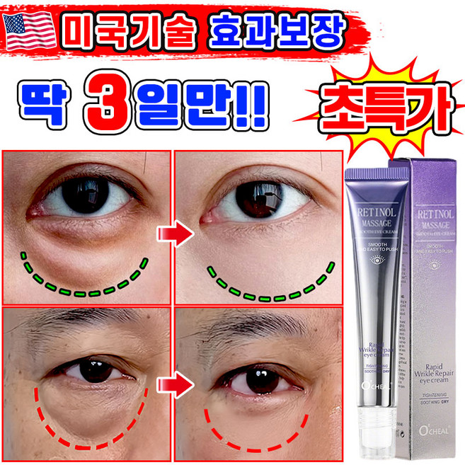 [효과보장] 1/1+1/2+2 아이백 리프팅 900샷 아이크림 눈 밑 지방 볼륨 개선 눈밑지방 제거 아이백 크림 다크서클 눈밑꺼짐 제거 아이케어 LUPEIYA 포장증정, 1개, 20g