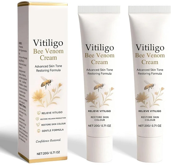 Vitiligo 트리트먼트 피부 색소 침착에 효과적인 개선, Vitiligo 트리트먼트, 백반증 케어 크림, 피부 - 쿠팡
