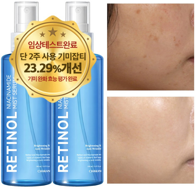기미 주근깨 색소침착 미백 수분 보습 레티놀 나이아신아마이드 미스트세럼, 2개, 150ml