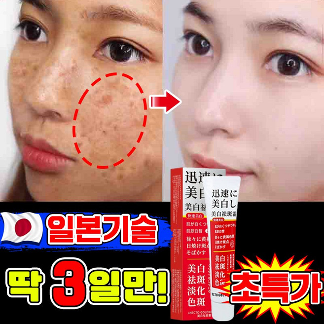 [피부과 추천] 1/1+1/2+2 멜라논 크림 기미크림 기미 잡티 검버섯 주근깨 제거 미백 크림 착색 들깨기미크림 색소침착 화이트닝 LUPEIYA 포장증정, 1개, 38g