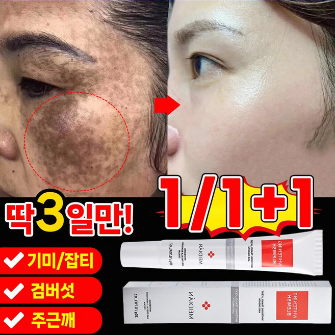 [국내배송] 1/1+1 기미 크림 잡티 검버섯 주근깨 제거 멜라토닝 멜라논 크림 화이트닝 스팟 색소침착 미백 앰플, 3개, 20g