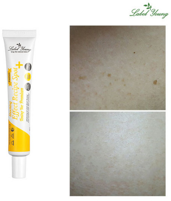[라벨영] 검버섯+기미+색소침착케어 쇼킹효과레시피스팟토닝 프리미엄, 30ml, 1개