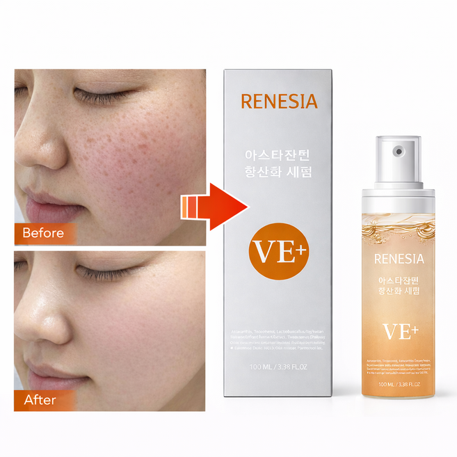 [비타민C 6000배/기미 7일개선]여성 에센스 세럼 얼굴 에센스 비타민C앰플 기미세럼 기미앰플 레티놀 크림 EGF앰플 마린 아스타잔틴 기미토닝 캡슐 세럼, 1개, 100ml