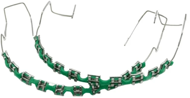 트렌디한 교정기 주얼리 세트 2개 | 화려한 치아 교정기 반짝이 체인 | 소녀 및 청소년을 위한 치아 교, 01 Green