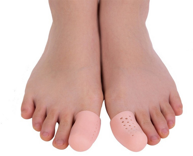 미즈코스 발가락 보호 골무 보호캡 엄지 발톱 튜브, 2개, 통풍형 살구