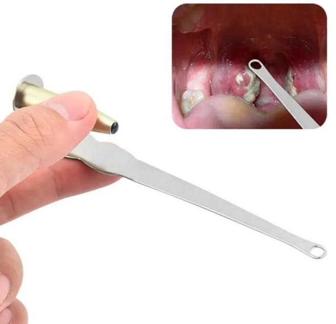 LED 라이트 스테인리스 스틸 편도 결석 제거기 구강 청결 관리 도구 귀지 편도 결석 제거 도구, [01] 옵션1