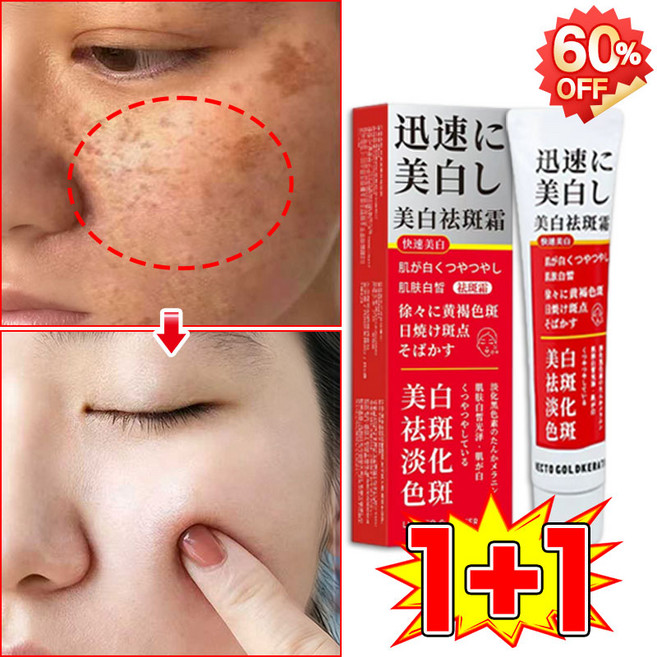 [피부과 추천] 멜라논 멜라닌 크림 기미크림 기미 잡티 검버섯 주근깨 제거 크림 착색 미백 크림 들깨기미크림 색소침착 화이트닝크림 LUPEIYA, 2개, 38g