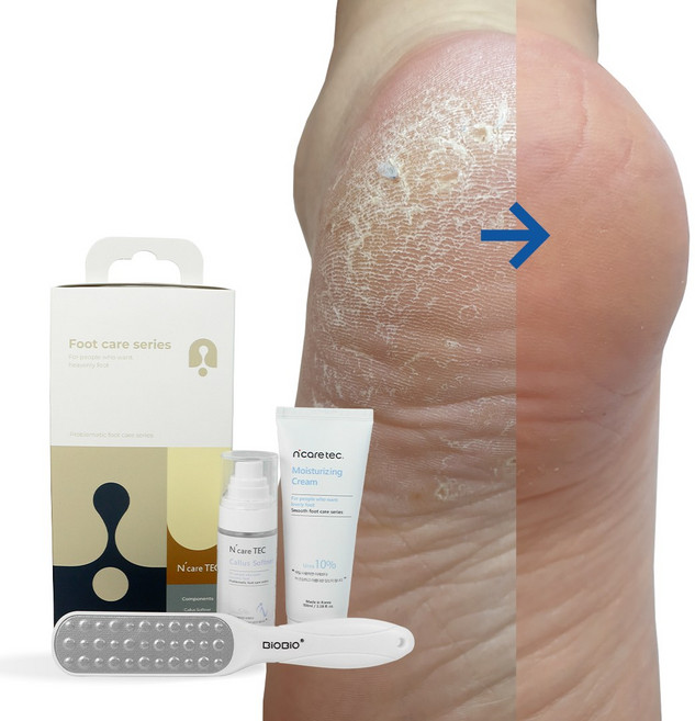 [ 3종셋트 행사 ] 엔케어텍 발각질 제거제 연화제 발바닥 각질 제거 각질 제거기 풋파일 풋 크림, 1개