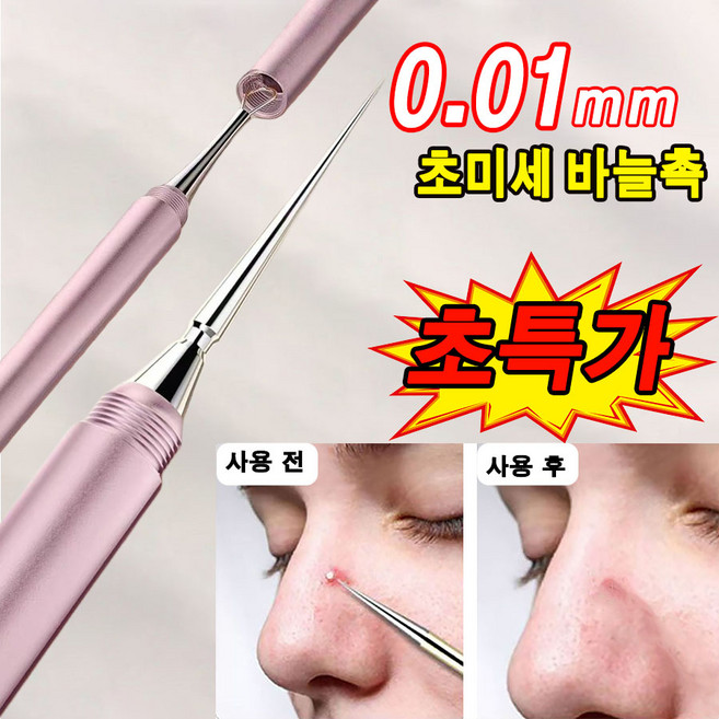 [빠른 출고] 여드름 압출기 피지 압출기 여드름 압출 초미세 통증 없는 여드름 바늘, 1개, 핑크