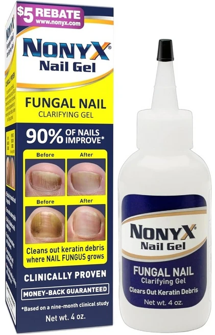 미국제조 Nonyx 손톱 클리어 젤 미국산 발톱 관리 - 쿠팡