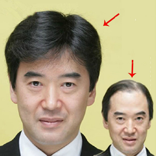 다소미얼 Apr.15 6번 리얼 헤어스타일 중노년 가발 리얼 헤어커버 중년의 남자 가발 단발남 쿨 아빠 단발머리남발Z, 2_내 추 럴 블랙 고온 사 [정수리 크기 시 뮬 레이, 1개