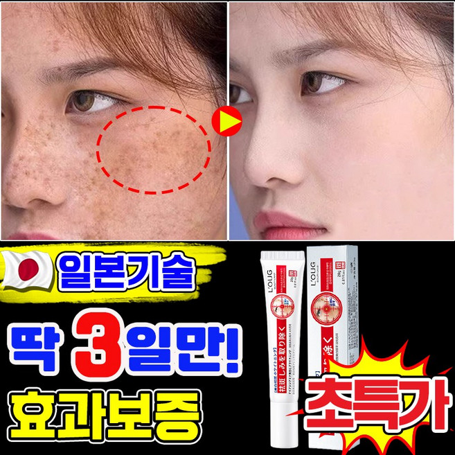일본기술 기미크림 기미 잡티 검버섯 흑자 제거크림 멜라논 멜라닌 크림 착색 미백 크림 색소침착 LUPEIYA 포장증정, 1개, 20g
