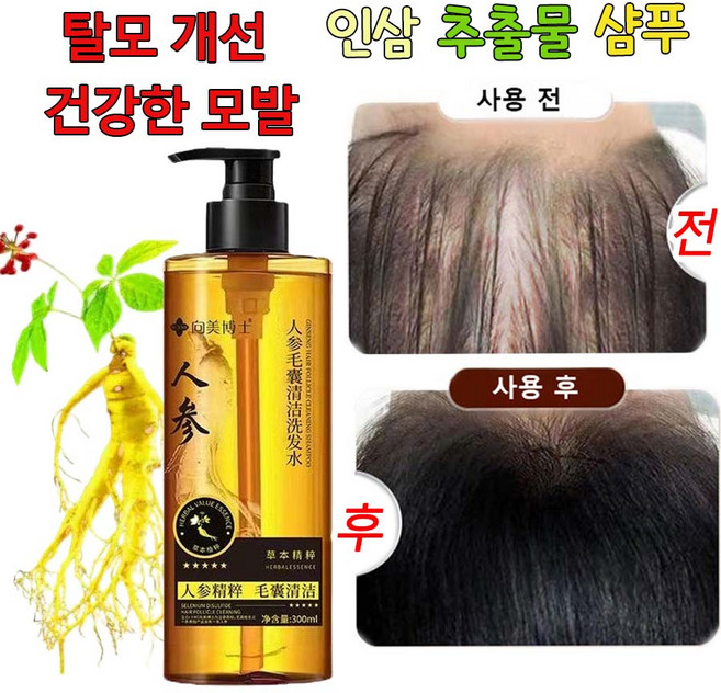 인삼 샴푸 탈모 샴푸 인삼 추출물로 두피에 생기 충전 탈모 완화 두피 클렌져, 4개, 300ml