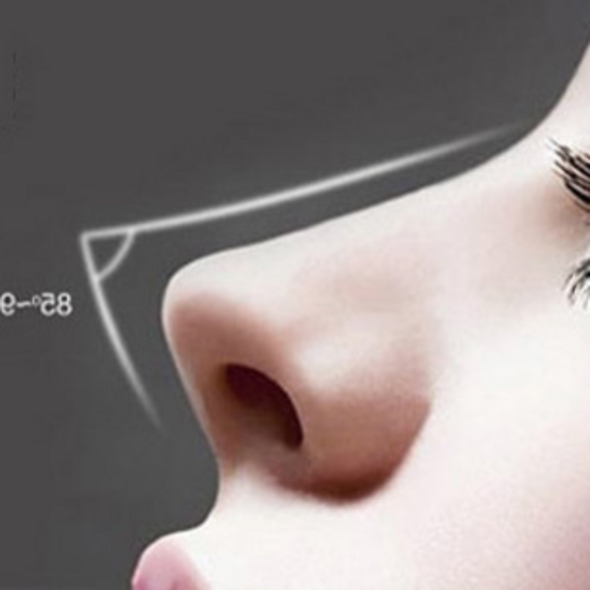 코볼축소 휜코교정기 복코교정 매부리코교정 오똑코교정기, 1개, 반투명