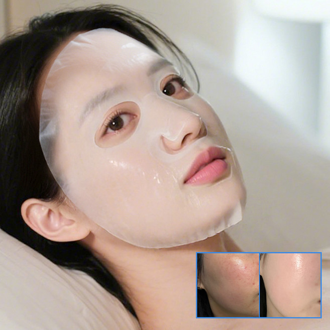 스킨부스터 메디팩 72샷 바이오셀룰로오스 마스크팩 4개입 (강남 전문기관 입점 완료), 5개