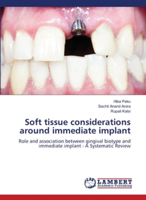 (영문도서) Soft tissue considerations around immediate implant Paperback, LAP Lambert Academic Publis..., English, 9786205502228