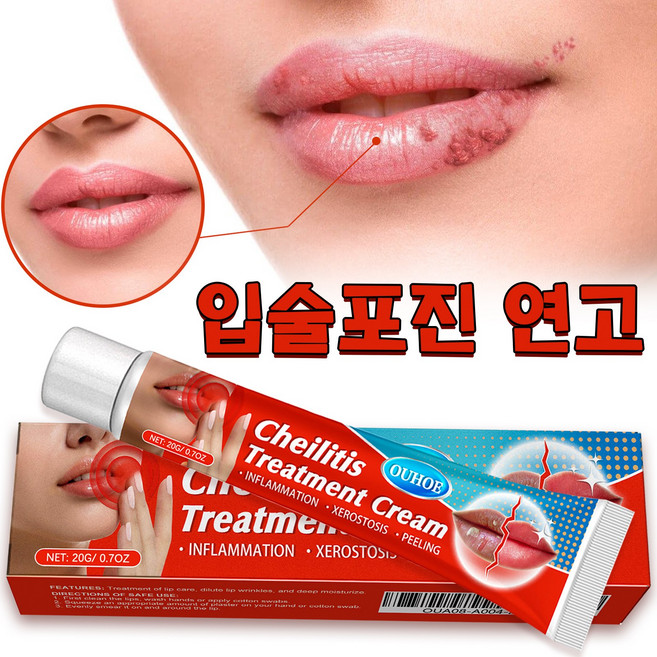 천연 허브 성분/힐링 입술포진/입술부음 SM001, 1개, 20g, 무색무취. 색깔도 냄새도 없다.