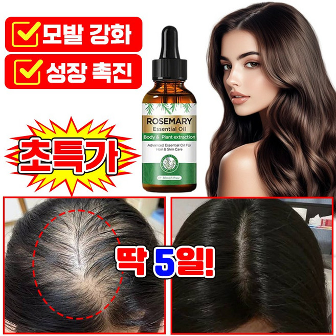 [천연성분] 로즈마리 오일 100% 탈모 헤어오일 두피 머리 영양제 모낭 에센스 헤어 앰플 세럼 남여공용 두피쿨링 저자극, 2개, 30.1ml