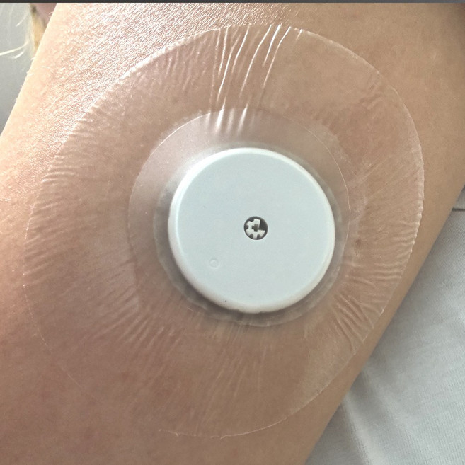 NEW 무채혈 연속 혈당측정기 전용 방수 패치 무접착4cm 리브레2 케어센스 데스콤 바로젠 보완 고정 테이프, 1세트, 20개입