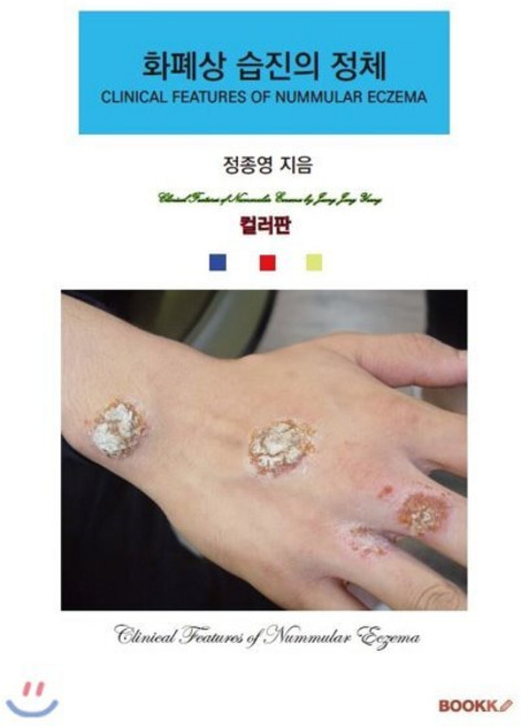 화폐상 습진의 정체 (컬러판), BOOKK(부크크), 9791137227941, 정종영 저