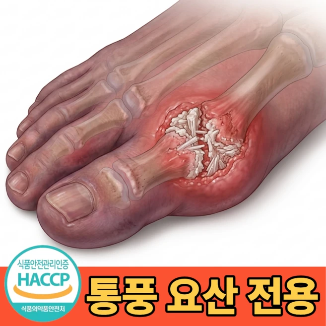 통풍 요산배출 영양제 요산 수치 낮추는, 1개, 60정 - 쿠팡