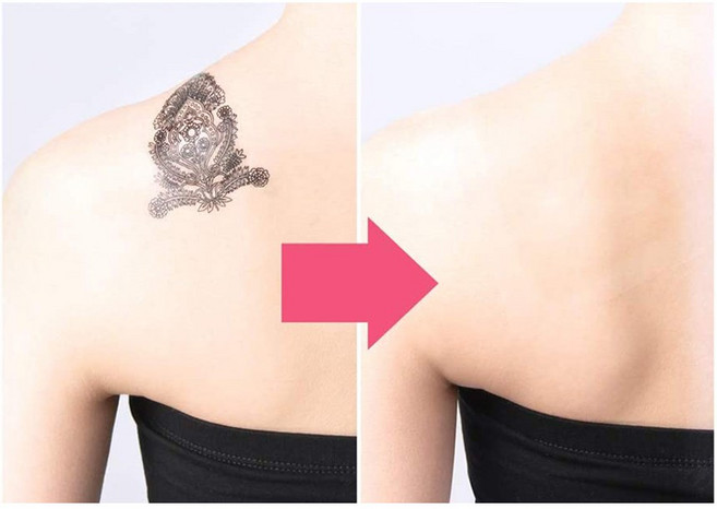 타투 문신 가리는 커버 가리기 흉터 스티커, 3개, 대형, 핑크내츄럴