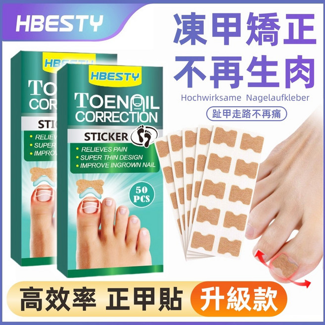 HBESTY 凍甲矯正貼片 嵌甲捲甲護理貼, 1個, 正甲貼100貼買1盒送1盒（到手2盒）
